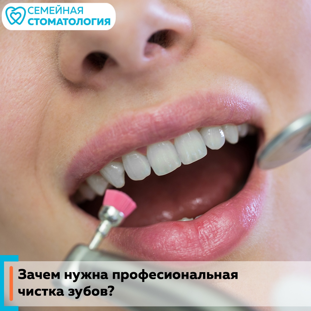 "Семейная стоматология" предлагает вылечить зуб и получить в подарок профессиональную чистку
