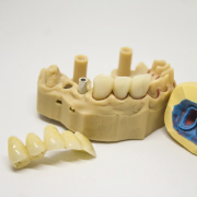 Этап Коронки на имплант в Семейной стоматологии