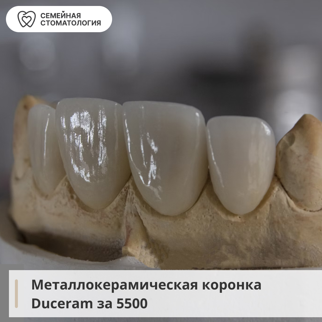 «Семейная стоматология» запустила акцию на установку немецкой коронки 