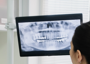 Панорамный снимок челюсти (Ортопантомограмма)