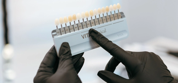 Исправление прикуса Элайнерами