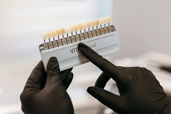 Брекеты на верхнюю челюсть