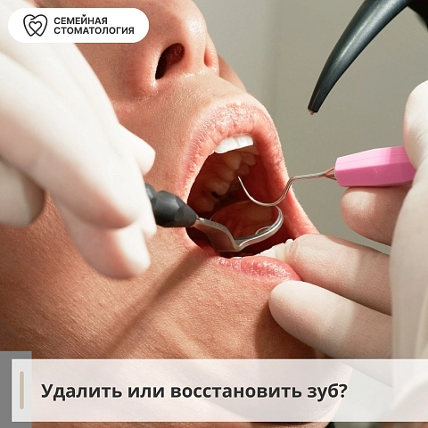 Удалить или восстановить зуб?