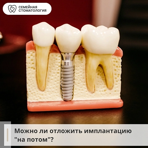 Можно ли отложить имплантацию "на потом"?