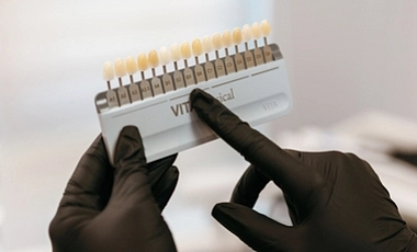 Пародонтологическая чистка зубов