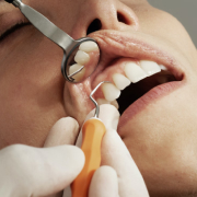 Этап Пластика десны в Семейной стоматологии